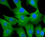NUR77 Recombinant Rabbit Monoclonal Antibody (JM59-11)