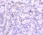 MRE11 Recombinant Rabbit Monoclonal Antibody (JM11-18)