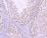 XRCC1 Recombinant Rabbit Monoclonal Antibody (JA11-47)