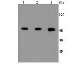 Calcineurin A Recombinant Rabbit Monoclonal Antibody (JA64-11)