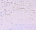 Cathepsin B Antibody in Immunohistochemistry (Paraffin) (IHC (P))