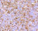 FGF21 Recombinant Rabbit Monoclonal Antibody (JA10-97)