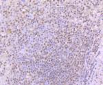 53BP1 Antibody in Immunohistochemistry (Paraffin) (IHC (P))