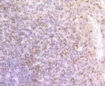 DCLK1 Antibody in Immunohistochemistry (Paraffin) (IHC (P))