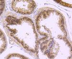 DCLK1 Antibody in Immunohistochemistry (Paraffin) (IHC (P))