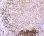 DCLK1 Antibody in Immunohistochemistry (Paraffin) (IHC (P))