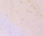 DCLK1 Antibody in Immunohistochemistry (Paraffin) (IHC (P))