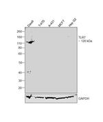 TLR7 Recombinant Rabbit Monoclonal Antibody (JA93-11)