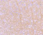 PRKAR2B Antibody in Immunohistochemistry (Paraffin) (IHC (P))