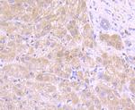 Tyrosinase Antibody in Immunohistochemistry (Paraffin) (IHC (P))
