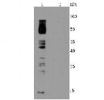 Phosphotyrosine Antibody in Western Blot (WB)