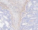 FAP Antibody in Immunohistochemistry (Paraffin) (IHC (P))