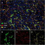 FAP Recombinant Rabbit Monoclonal Antibody (JA56-11)