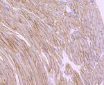 Alpha Sarcoglycan Antibody in Immunohistochemistry (Paraffin) (IHC (P))