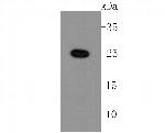 LIN28A Recombinant Rabbit Monoclonal Antibody (JA10-63)