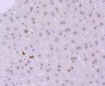 MSH6 Antibody in Immunohistochemistry (Paraffin) (IHC (P))