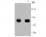 CaMKII delta Antibody in Western Blot (WB)