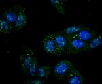 IKK gamma Recombinant Rabbit Monoclonal Antibody (JA11-83)