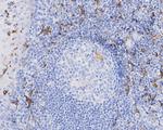 CD163 Antibody in Immunohistochemistry (Paraffin) (IHC (P))