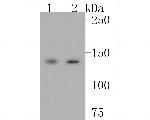 Leptin Receptor Antibody in Western Blot (WB)