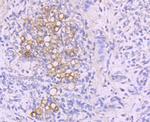 NFATC1 Antibody in Immunohistochemistry (Paraffin) (IHC (P))