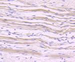NFATC1 Recombinant Rabbit Monoclonal Antibody (JA81-03)