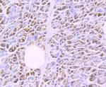 LPL Recombinant Rabbit Monoclonal Antibody (JA22-02)
