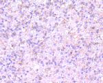 Clathrin Heavy Chain Antibody in Immunohistochemistry (Paraffin) (IHC (P))