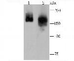 Clathrin Heavy Chain Antibody in Western Blot (WB)