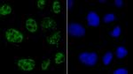 hnRNP A1 Recombinant Rabbit Monoclonal Antibody (JA39-21)