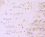 Aggrecan Recombinant Rabbit Monoclonal Antibody (JA40-23)