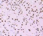 MEF2A Recombinant Rabbit Monoclonal Antibody (JA33-04)