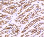 CRYAB Antibody in Immunohistochemistry (Paraffin) (IHC (P))
