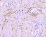 CRYAB Antibody in Immunohistochemistry (Paraffin) (IHC (P))