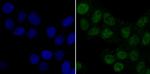 PDK1 Antibody in Immunocytochemistry (ICC/IF)