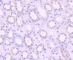 PDK1 Antibody in Immunohistochemistry (Paraffin) (IHC (P))