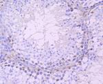 DAZL Recombinant Rabbit Monoclonal Antibody (JA10-36)
