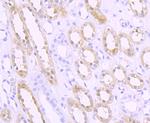 SPHK1 Recombinant Rabbit Monoclonal Antibody (JA31-14)