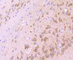 IP3 Receptor 1 Recombinant Rabbit Monoclonal Antibody (JA11-35)