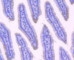 NMDAR2A Recombinant Rabbit Monoclonal Antibody (JA31-20)