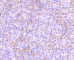 PKC epsilon Recombinant Rabbit Monoclonal Antibody (JA38-21)