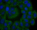 Calpain 2 Recombinant Rabbit Monoclonal Antibody (JA43-41)