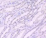 SIN3A Antibody in Immunohistochemistry (Paraffin) (IHC (P))