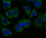 PRDX3 Recombinant Rabbit Monoclonal Antibody (JA53-21)