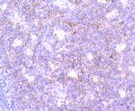 SNAP23 Recombinant Rabbit Monoclonal Antibody (JA73-15)