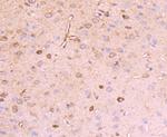 Reelin Recombinant Rabbit Monoclonal Antibody (JA63-13)