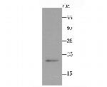 PMP22 Recombinant Rabbit Monoclonal Antibody (JM52-30)