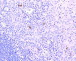 CD1a Recombinant Rabbit Monoclonal Antibody (JM21-33)