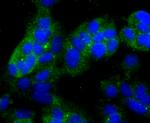 NDRG1 Recombinant Rabbit Monoclonal Antibody (JM32-02)