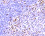 Thymidylate Synthase Recombinant Rabbit Monoclonal Antibody (JM33-20)